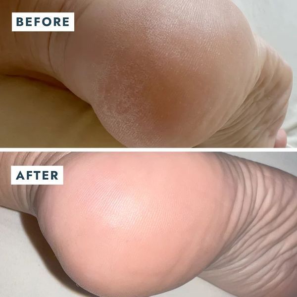Набір відновлювальний для п'ят Heel Repair Duo більзам +зволожувальні шкарпетки VFC001MNT фото