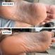 Набір відновлювальний для п'ят Heel Repair Duo більзам +зволожувальні шкарпетки VFC001MNT фото 4